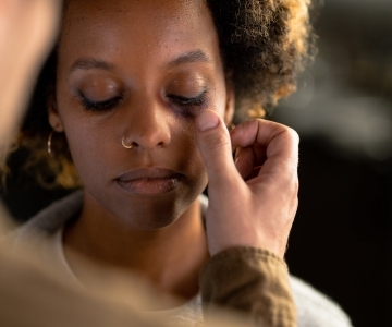 a person touching a woman s eye with a bruise